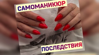 Маникюр Самой Себе. Что Делать Мастеру с этим Счастьем. Выравнивание Клюющих Ногтей.