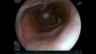 Hereditary esophageal dysfunction in the Miniature Schnauzer dog