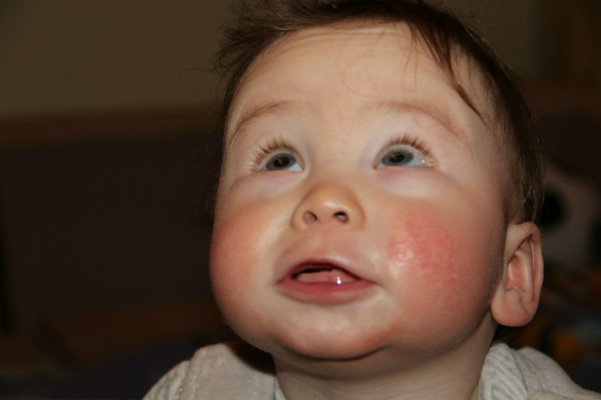 Анна Эльсон Михална | Санкт-Петербург