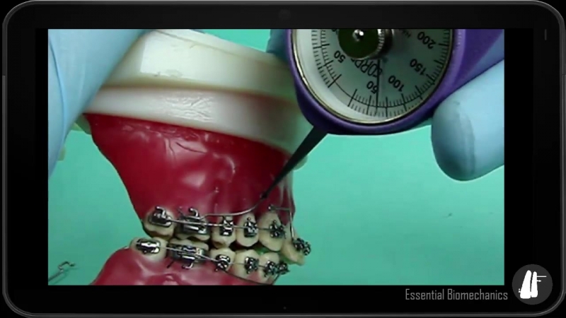 Three Piece Base Arch Appliance Essential Biomechanics.