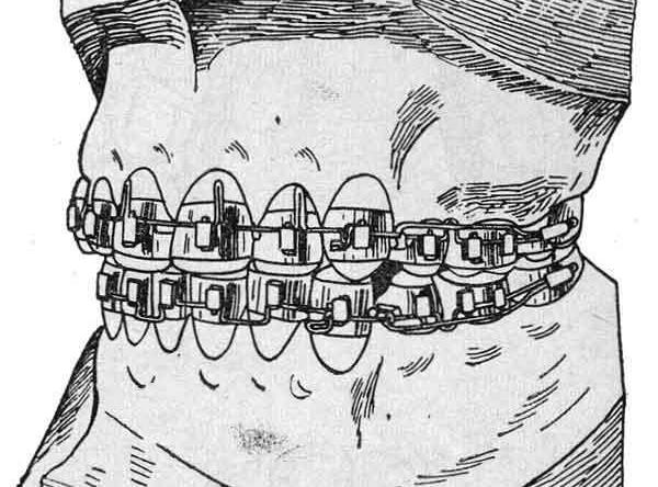 дневники ортодонта